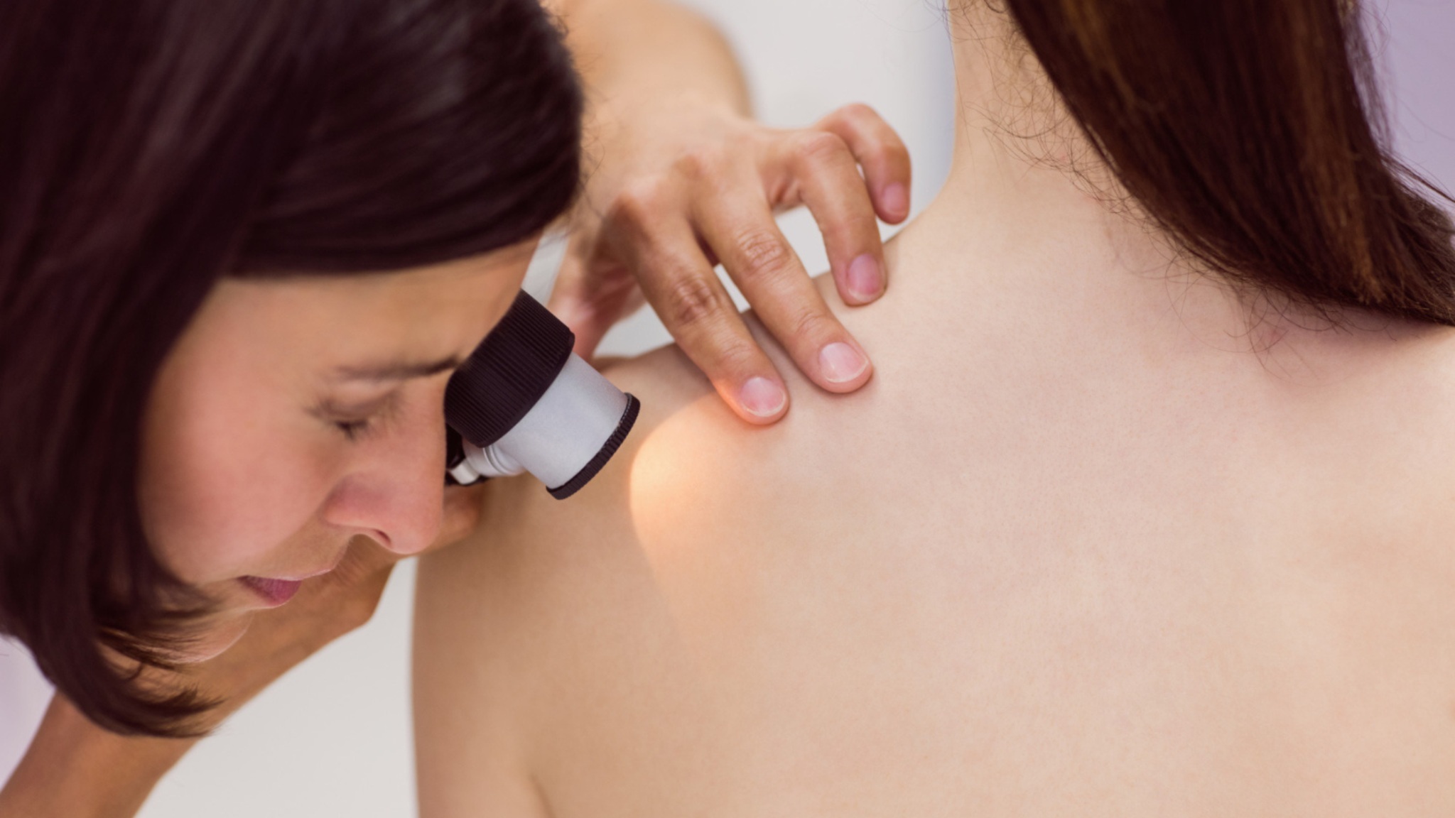 Can Mole Removal Leave a Scar