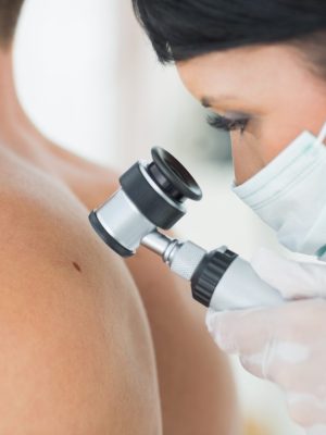 Closeup of dermatologist examining mole on back of male patient in clinic